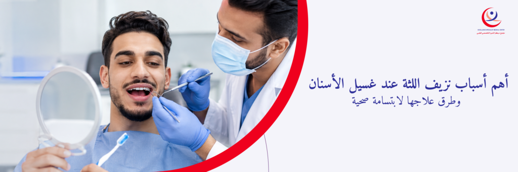 أسباب نزيف اللثة